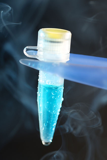 The stored sperm of about 400 men who had been diagnosed with cancer was damaged or destroyed due to a power problem with the storage freezer. (Photo: Shutterstock)